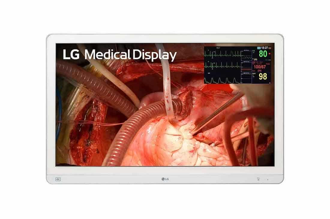 medical displays, medical screens, surgical display, 4k medical display, medical monitor, medical monitors, veterinary video monitors, veterinary facility planning, displays for new vet clinic, buying medical displays, radiology monitors, radiology screens, diagnostic monitors, radiology display