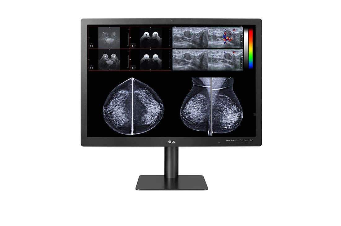LG 31_ 12MP IPS Radiology Monitor